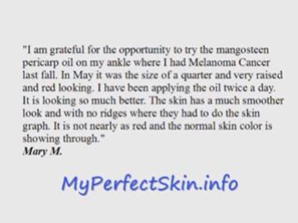 Melanoma Cure?  A Glimpse Testimonial...