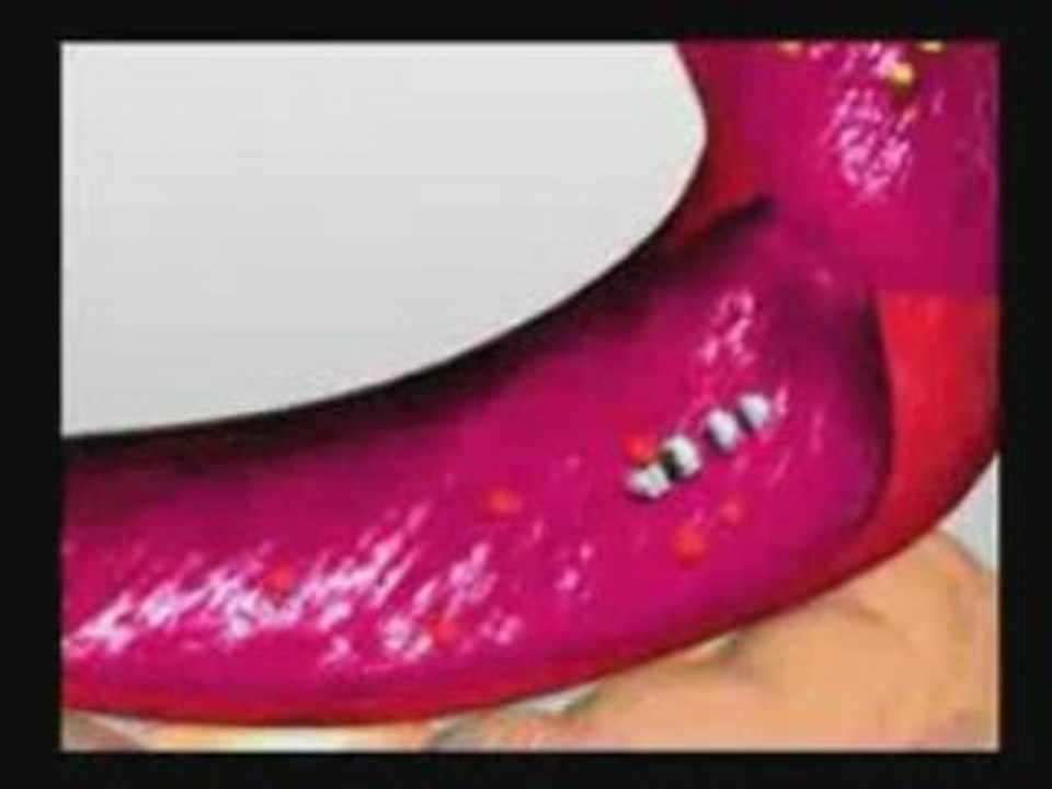 Serrapeptase as a Pain Reliever