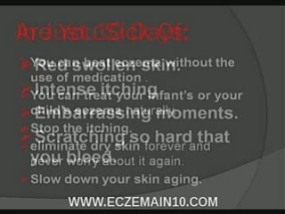 Best Eczema Treatments and Prevention