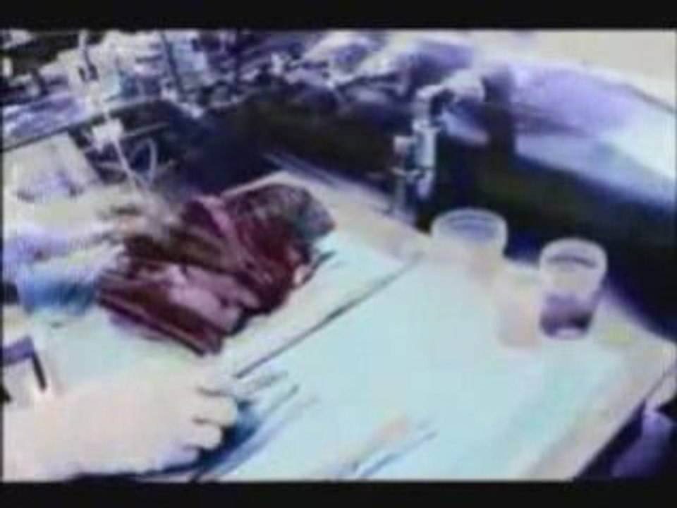 Necropsy - Decalcification