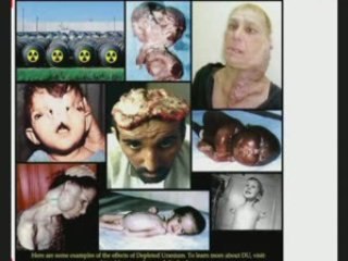 ISRAEL utilise des armes muni d'URANIUM sur GAZA