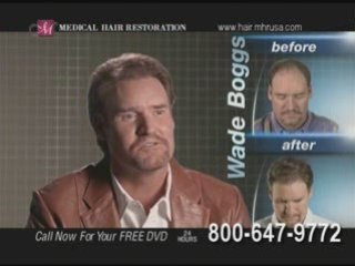 Non surgical hair restoration