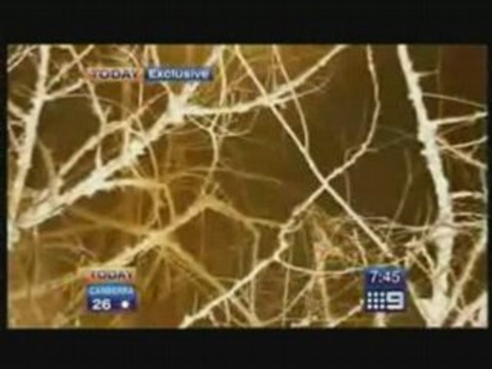 Australian Today show  interview with Robert Pattinson