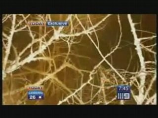 Australian Today show  interview with Robert Pattinson