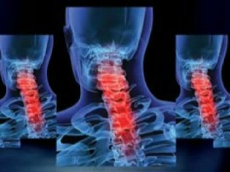 Chiropractic Richardson Tx Chiropractor Plano