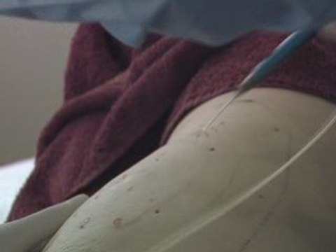 How To Find A Great Edmonton Liposuction Doctor