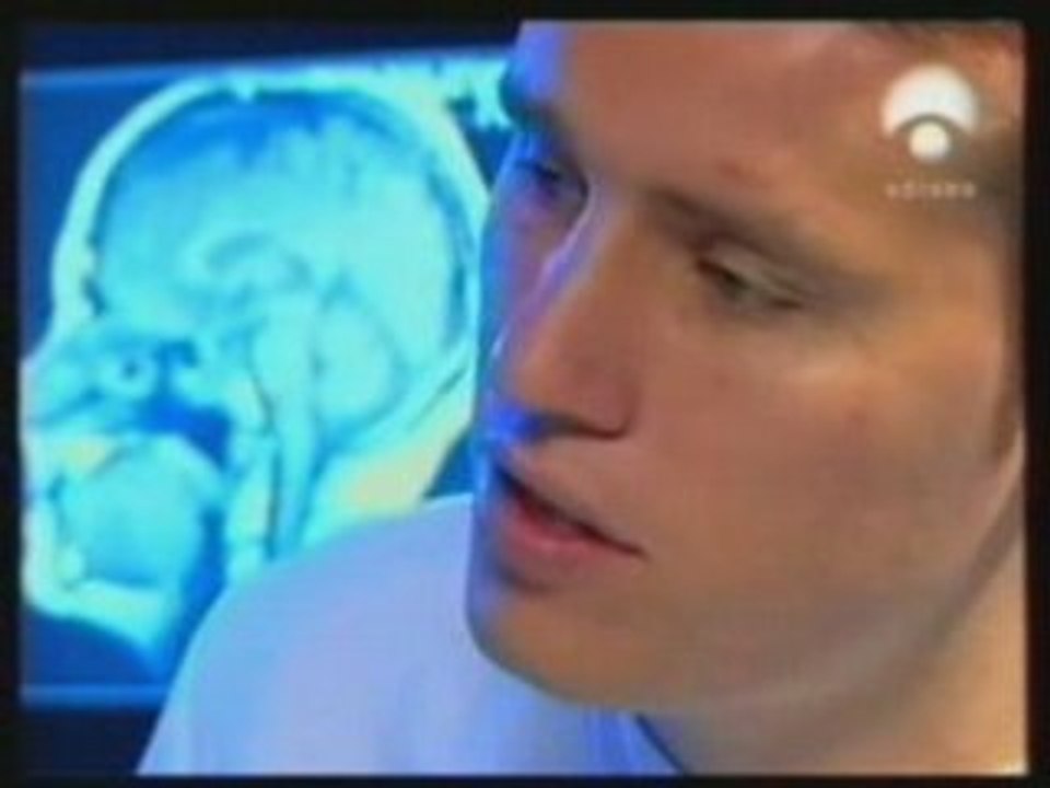 Rugby y conmociones cerebrales: Trastornos cognitivos