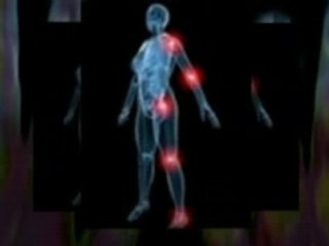 Arthritis Relief With Omega XL