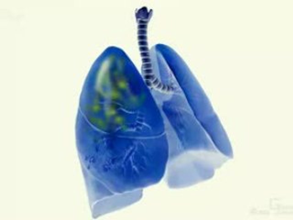 Graham Pseudomonas