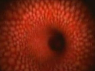 Test Affliction screen live