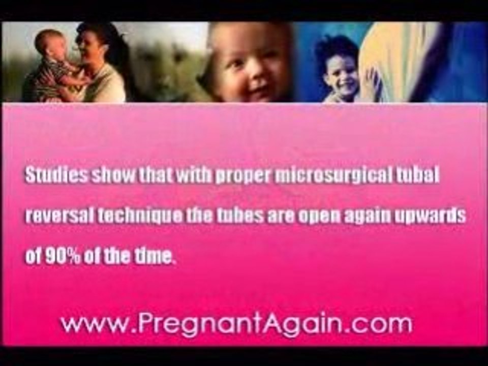 Tubal Reversal Facility, Essure Tubal Reversal, Tubaligation