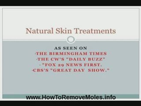 How To Remove Moles And Skin Tags Naturally
