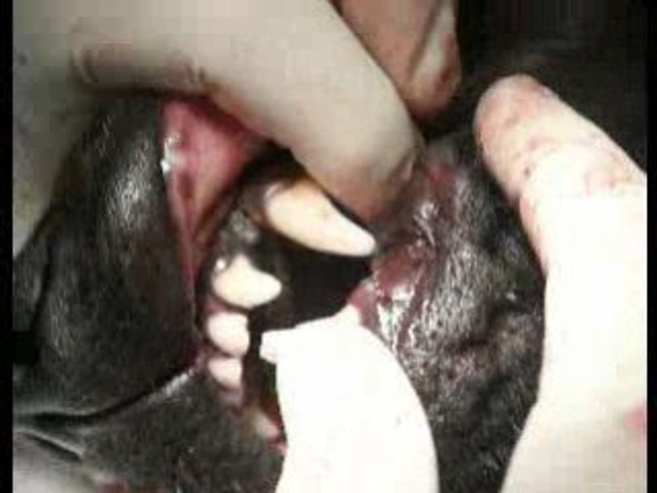 Reduction fracture mand