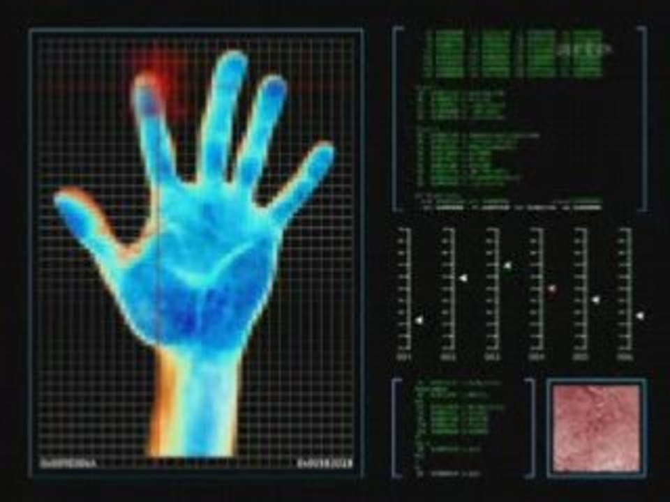 Attention Biometrie 3/3