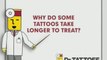 Laser Tattoo Removal - All About Laser Tattoo Removal