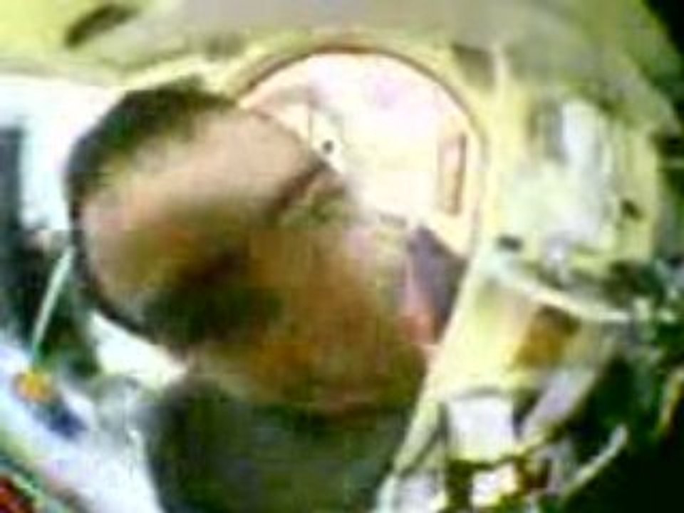 Bileu grant angle