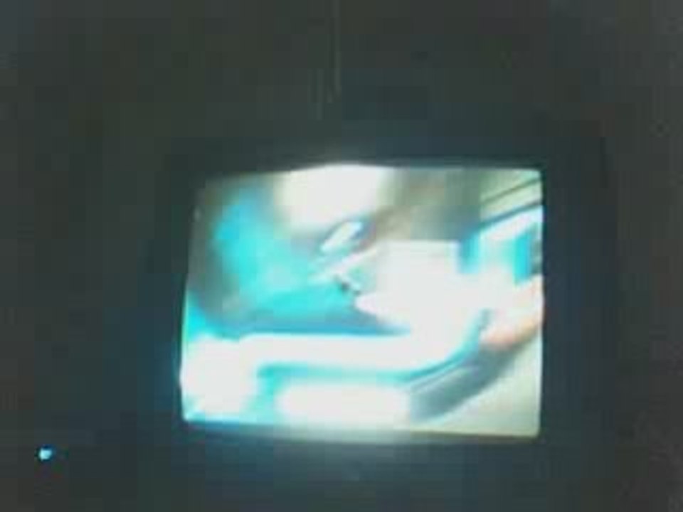 LBP dead space