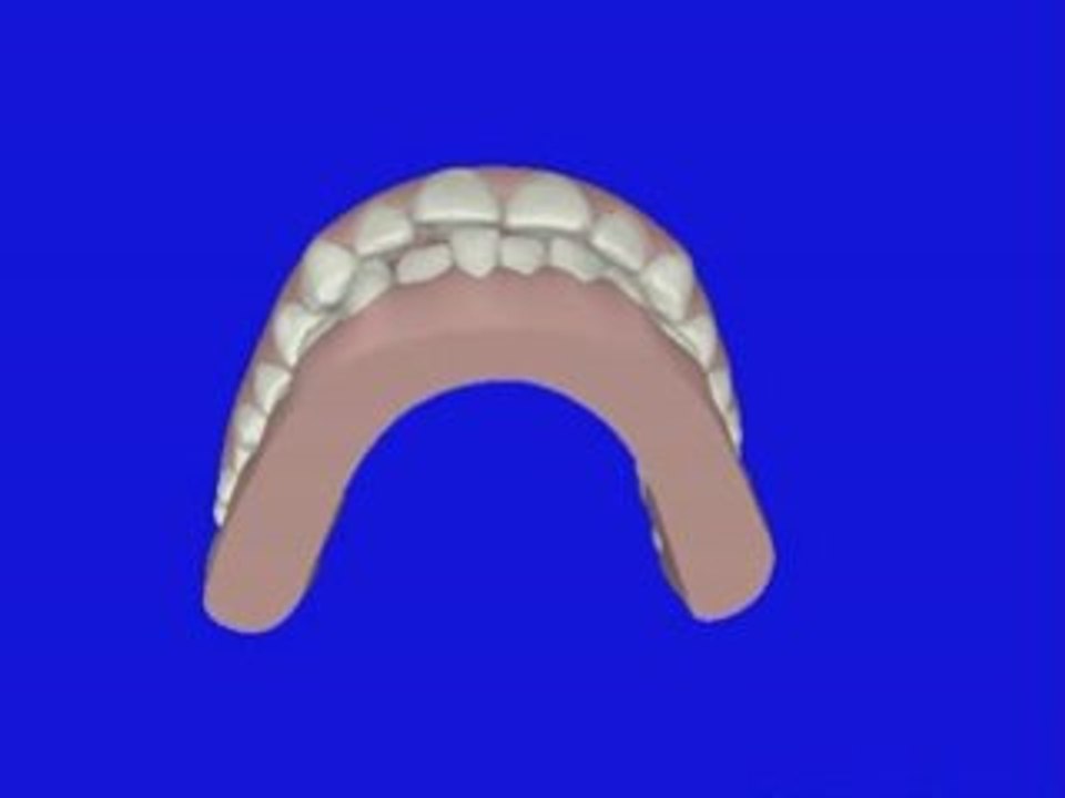 MalekTreatment