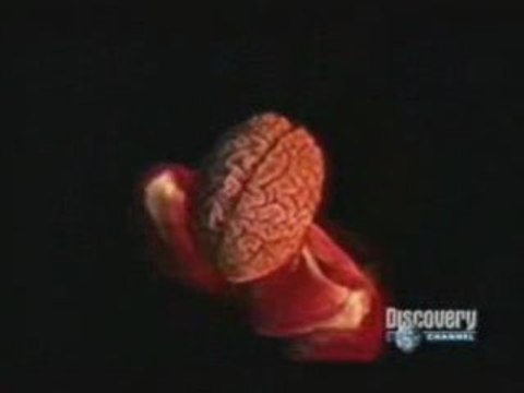 Imagineria Medica: Humano visible