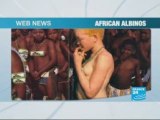 Murders of African albinos