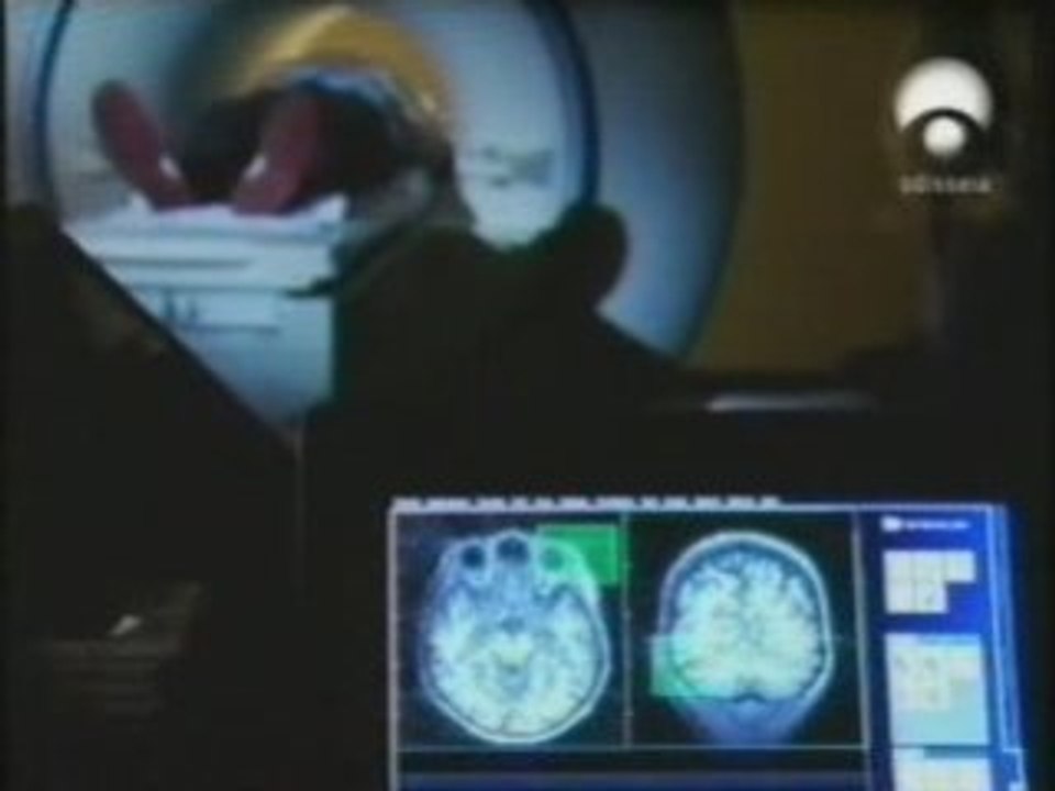 Sinestesia: Estudio RMf