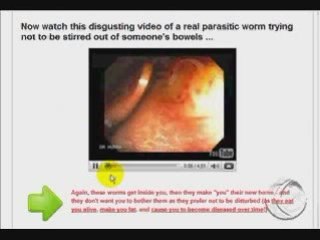 LIVE PARASITES Pics in your Colon - Fat Loss Secret Review