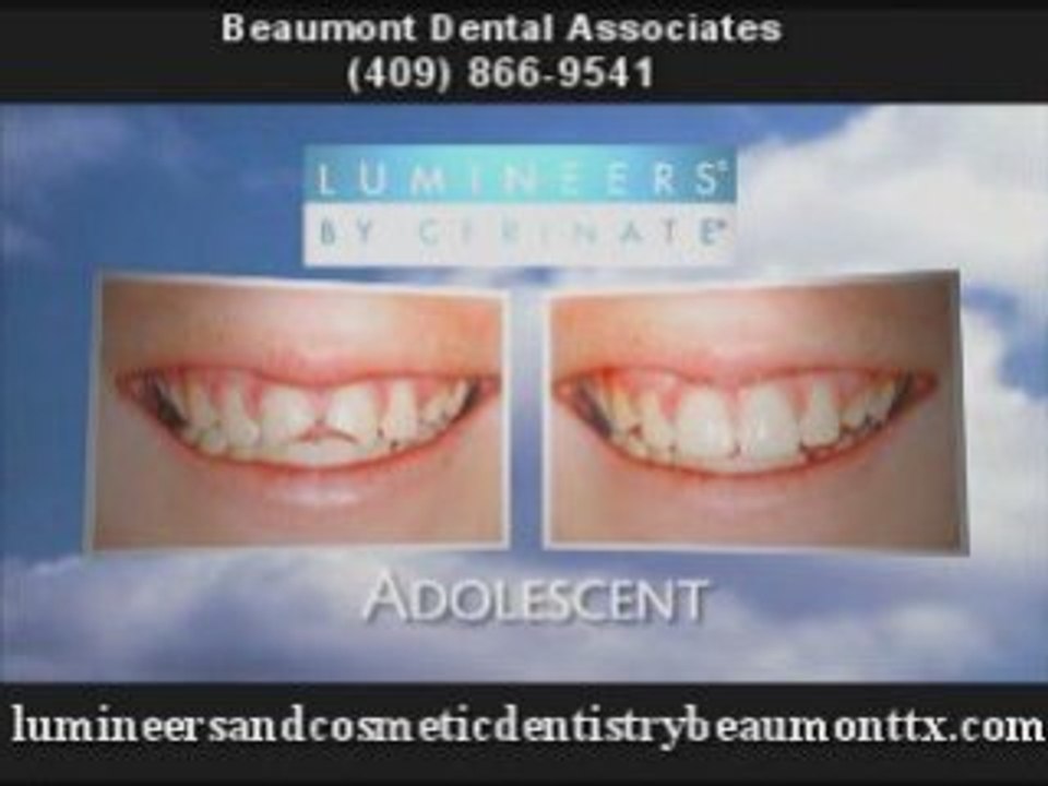 Cosmetic Dentists Beaumont TX