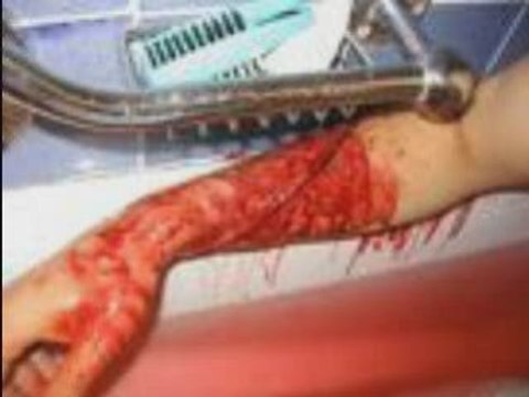 Projet famine-Aia-Cicatrices recordz