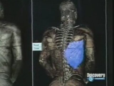 Proyecto hombre visible (2)