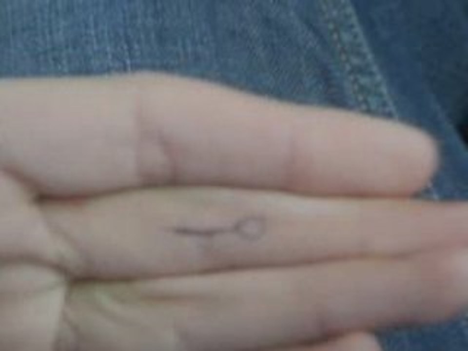 X-Finger