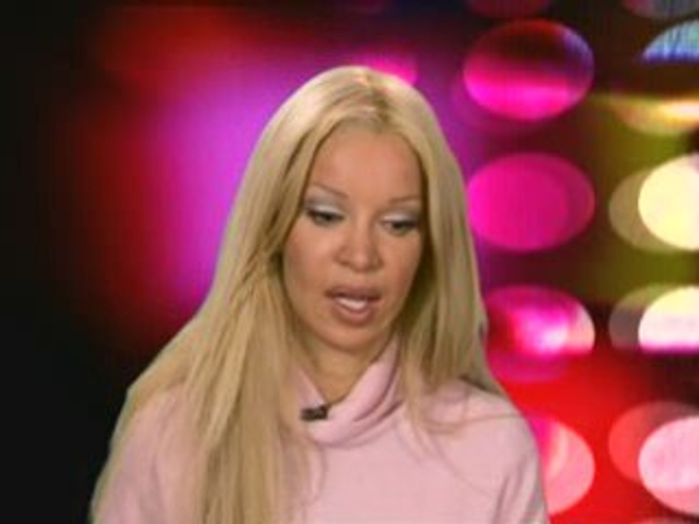 Alicia Douvall reflects on plastic surgery