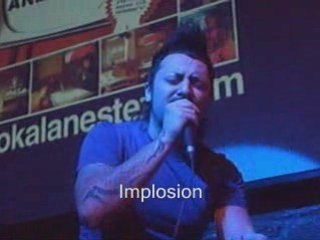 Hayko Cepkin - Yalnız kalsın - lokal anestezi (16.02.09)