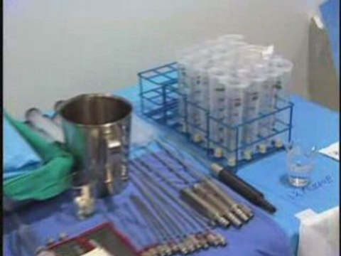 Buttock Implants 90210 | Buttock Lift Beverly Hills CA