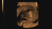 BabySchatzim3D-14+1m4v