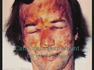 NARCONON Georgia methamphetamine.