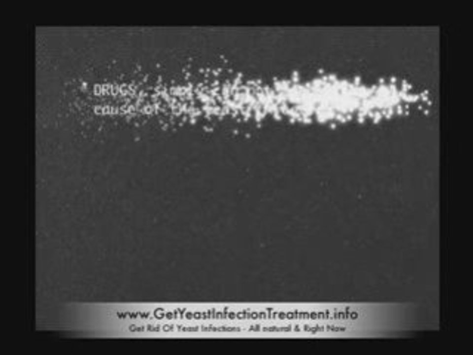 Cure Yeast Infection? Natural treatment is best.Learn how to