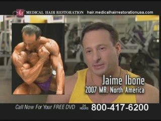 Get the Hair Loss Solution in San Diego