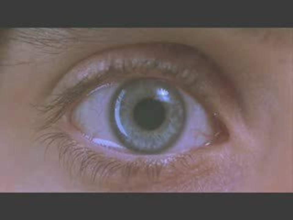 Requiem eye