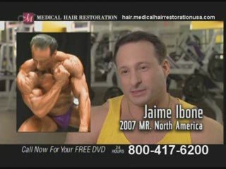 Get Surgical Hair Replacement in Cleveland