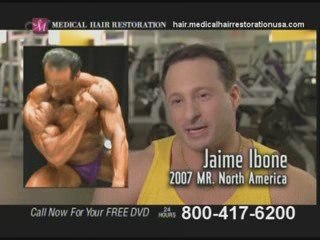 Get Surgical Hair Replacement in Chicago