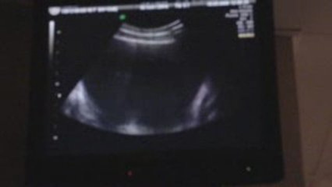 Echo 1