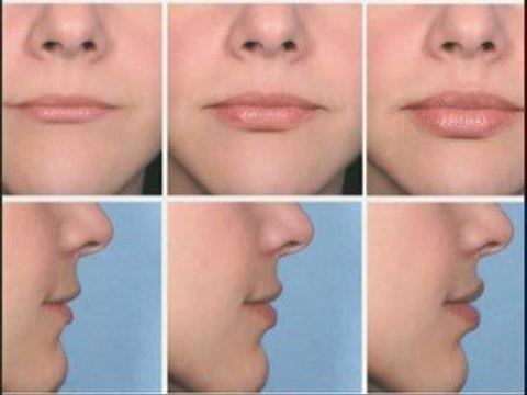 The Merz Scales First Scales to Measure Skin’s Agin...