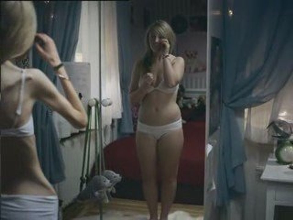 Campagne choc contre l'Anorexie