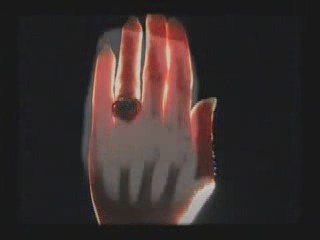 histoire radiographie