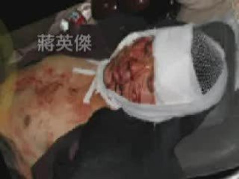 Violence at a Beijing Hot Pot