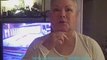 DALLAS FACELIFT FAT GRAFTING UPPER EYELID VIDEO DIARY
