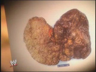 Superstar billy graham 4