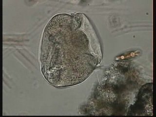 TRICHODINA CILIATE
