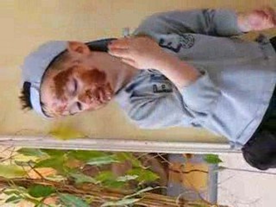 mathéo avait mal aux dents