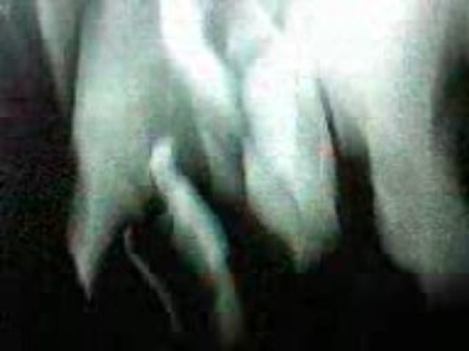 Concert de Fall Out Boy le 14 Mars